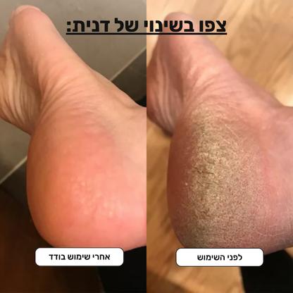Pedi+ מארז פדיקור ביתי Patent Prime
